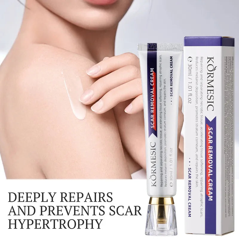 KOMESIC SCAR REMOVER CREAM